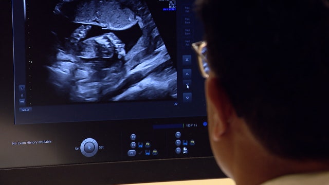 AdventHealth Tampa launches new OB-GYN residency program to address workforce issue in Bay Area