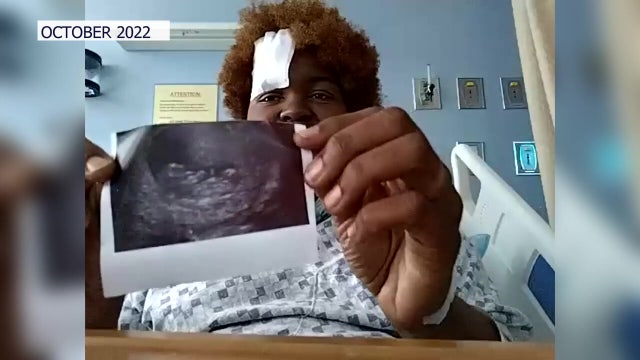 Pregnant mother shot in head loses ‘miracle baby’ days before due date: 'The world stopped'