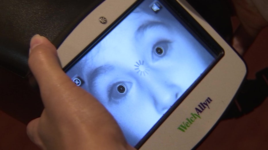 The new technology helps kids get the eye care they need.