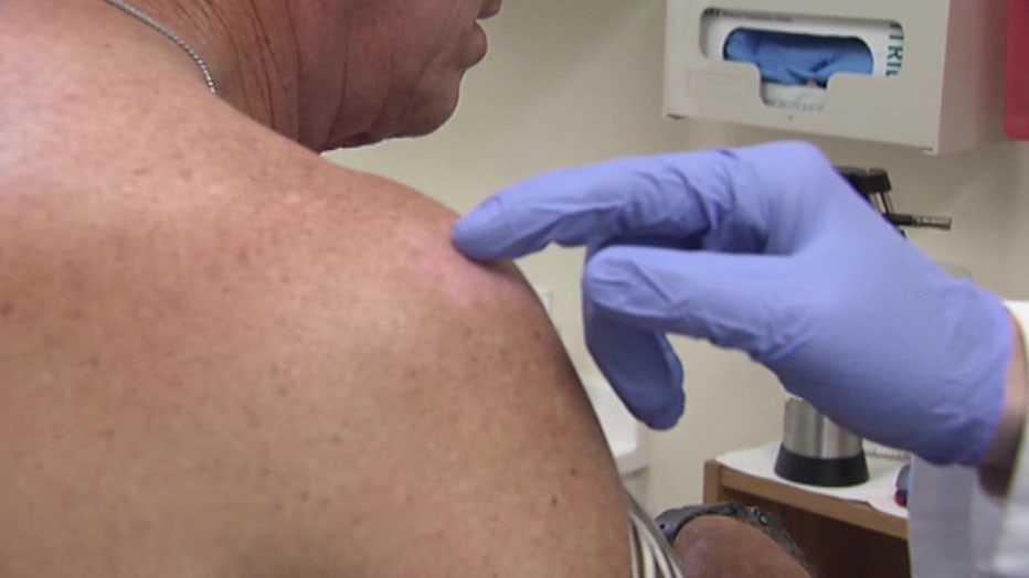 Doctors are being urged to check for the disease when patients come in about rashes.