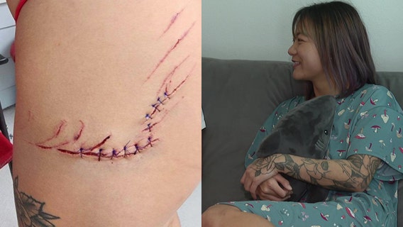 Shark bites woman near St. Pete Pier: ‘It was the perfect cocktail for the perfect storm’