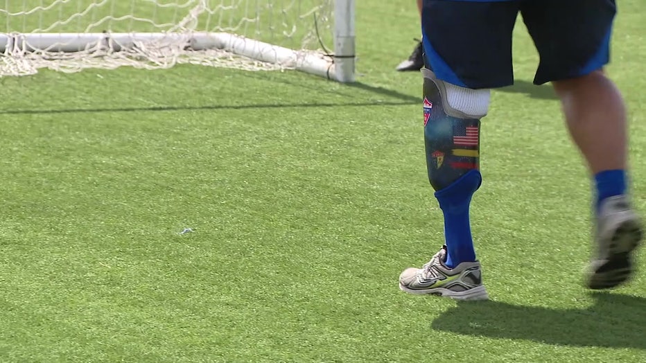 Carlos Marin's leg was amputated due to severe circulation problems.