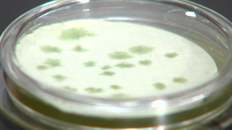 A Petri dish containing Vibrio vulnificus. 
