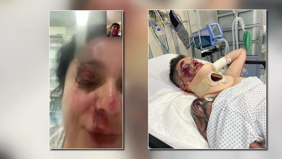 Ashley is awaiting surgery and Ortega says she can't leave unless she pays a $10,000-$20,000 bill in case insurance doesn't cover the cost of the operation.