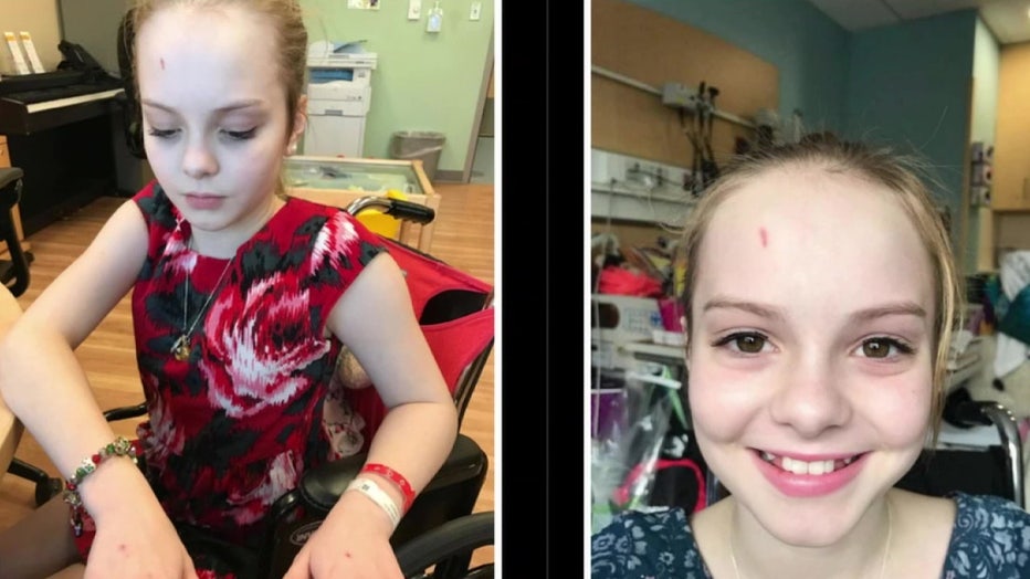 Side by side images of Maya Kowalski as she battled CRPS.