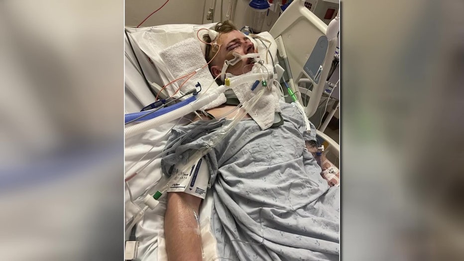 Kyle Higginbotham was injured in a devastating motorcycle crash. 