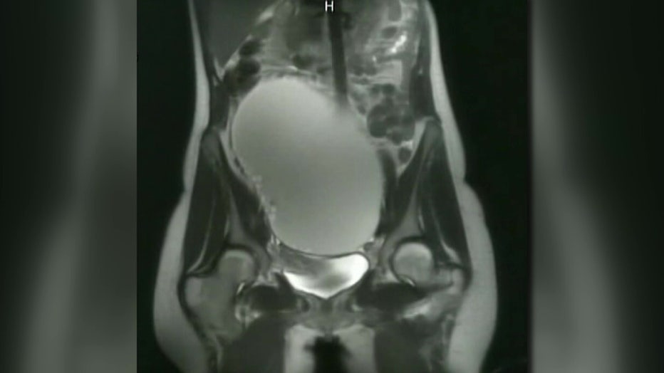 File: Medical scan