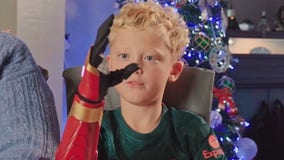 10-year-old boy receives 'Iron Man'-themed bionic arm in early Christmas miracle