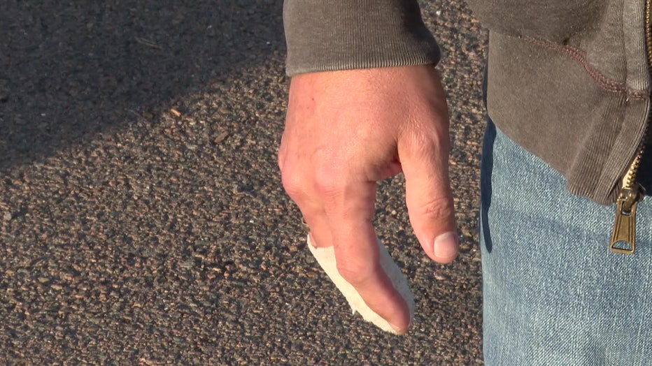Good Samaritan 'Dan' suffered an injury to his hands and some scrapes.
