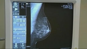 Breast cancer risk assessment tools could be lifesaving