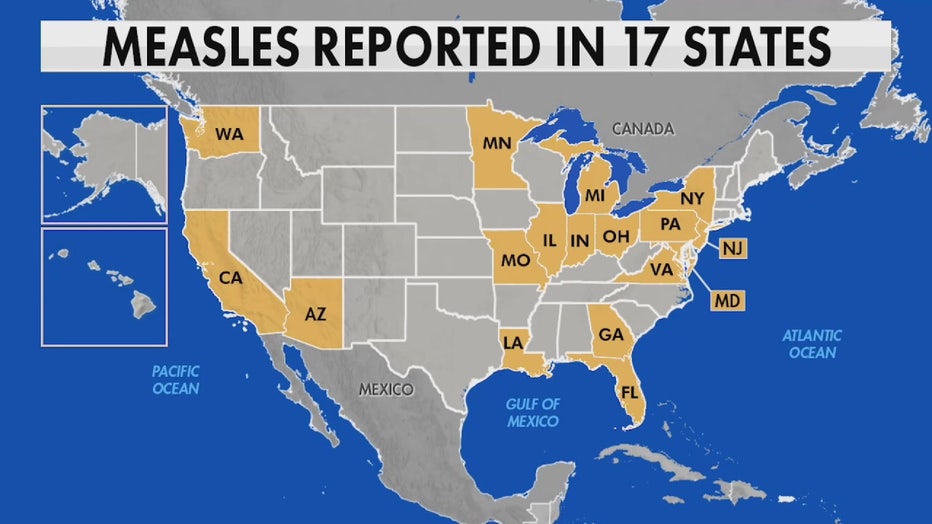 Map shows where measles has been reported. 