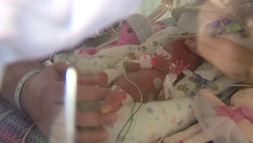 Bay Area family credits faith and March of Dimes' research for saving their daughter's life