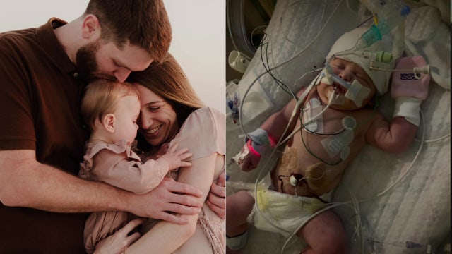 Parents of ‘miracle baby’ give back to the March of Dimes