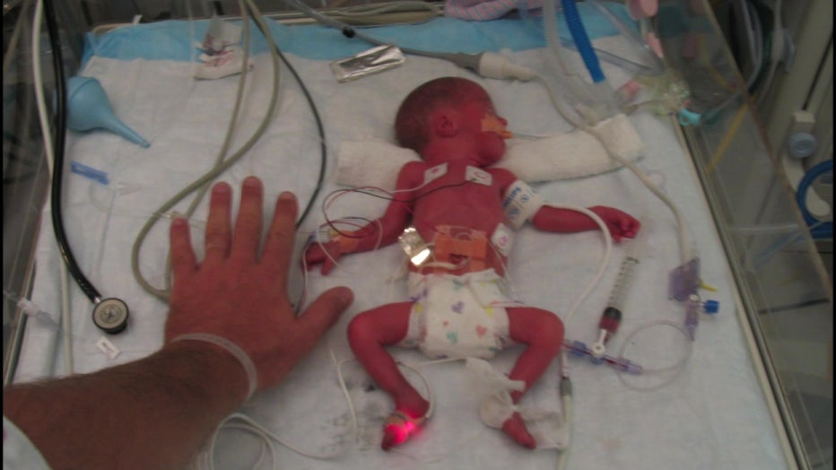 Ryleigh Butz was born three months premature. 