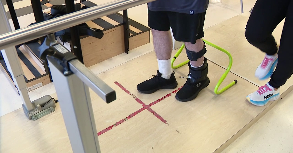 Tampa General Hospital introduces device aimed at improving stroke ...