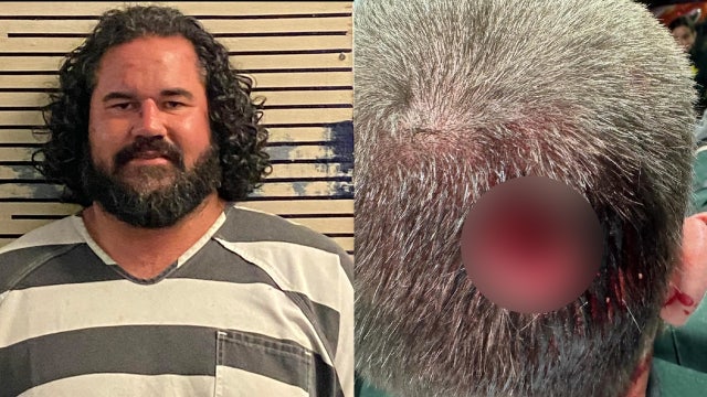 Man high on drugs bites chunk out of deputy’s head at Florida EDM music fest: HCSO