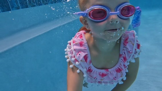 Tampa doctor helps young patient with brittle bones get extra protection