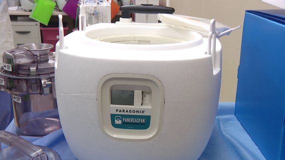 Tampa General Hospital using new ‘PancreasPak’ to improve transplants