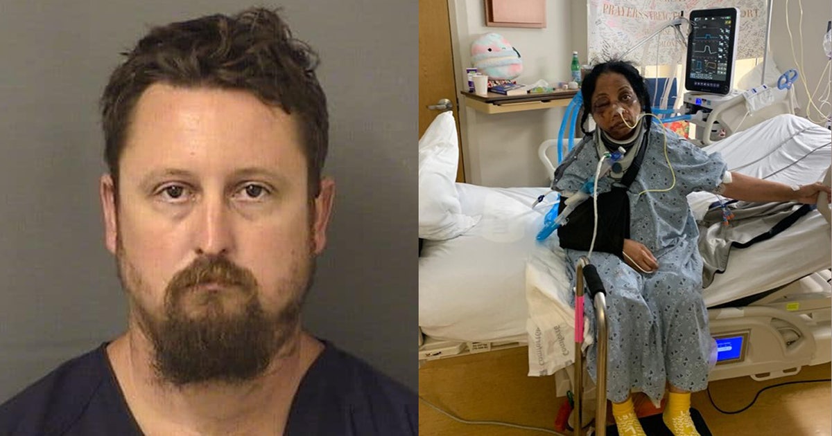 Nữ y tá ở Florida bị tấn công: Gia đình mong muốn có sự thay đổi sau vụ hành hung dã man bởi bệnh nhân theo Đạo luật Baker | FOX 13 Tampa Bay