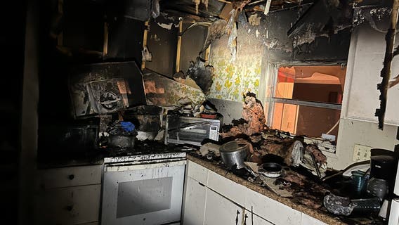 St. Pete firefighters rescue victim trapped in burning mobile home: Officials