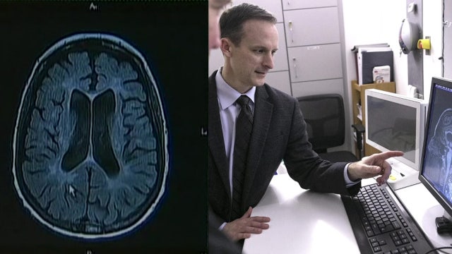 UF researchers using artificial intelligence to detect Parkinson's disease more accurately