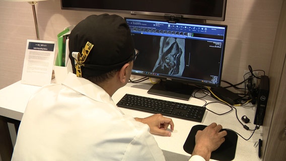 Bay Area doctor aims to raise awareness of endometriosis, help women get earlier diagnosis