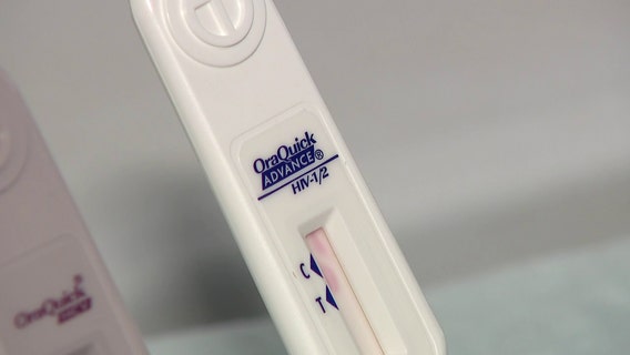 HIV programs in Pinellas face uncertainty amid budget cut talks