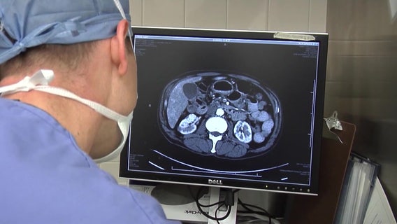 New glow in the dark technology, Cytalux, helping remove cancer cells