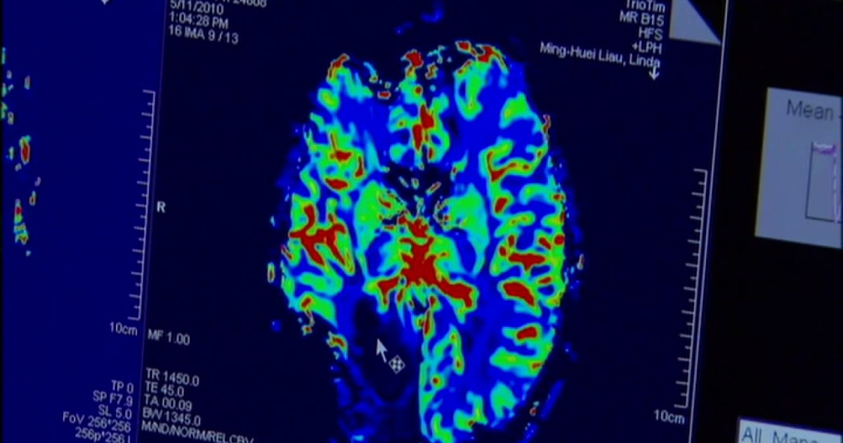 brain-cancer-pill.jpg?ve=1&tl=1