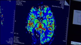 New FDA-approved pill offers hope for rare, deadly brain cancer