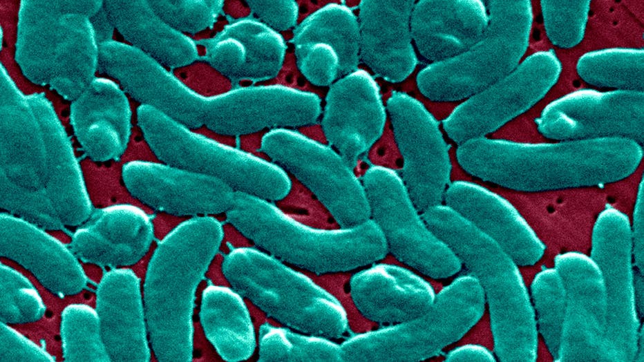 This Scanning Electron Micrograph Sem Depicts A Grouping Of Vibrio Vulnificus Bacteria; Mag. 13184X. Vibrio Vulnificus Is A Bacterium In The Same Family As Those That Cause Cholera. It Normally Lives In Warm Seawater And Is Part Of A Group Of Vibrios That Are Called "Halophilic" Because They Require Salt. V. Vulnificus Can Cause Disease In Those Who Eat Contaminated Seafood Or Have An Open Wound That Is Exposed To Contaminated Seawater. Among Healthy People, Ingestion Of V. Vulnificus Can Cause Vomiting, Diarrhea, And Abdominal Pain. In Immunocompromised Persons, Particularly Those With Chronic Liver Disease, V. Vulnificus Can Infect The Bloodstream, Causing A Severe And Life Threatening Illness Characterized By Fever And Chills, Decreased Blood Pressure Septic Shock, And Blistering Skin Lesions. V. Vulnificus Bloodstream Infections Are Fatal About 50% Of The Time. (Photo By BSIP/UIG Via Getty Images)