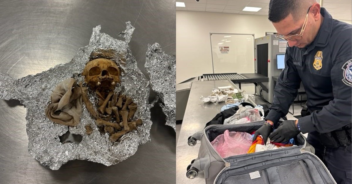 tpa-bones-main.jpg?ve=1&tl=1