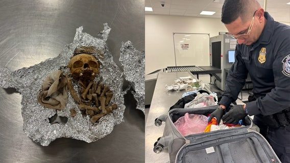 Bones, including portion of a skull, found in duffel bag at TPA: CBP
