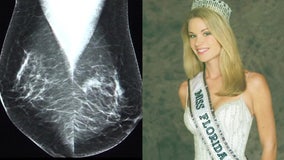 Two-time breast cancer survivor, former Miss Florida USA advocates for cancer patients