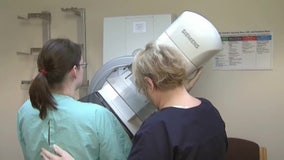 Breast cancer screenings buses help break down access barriers across Bay Area