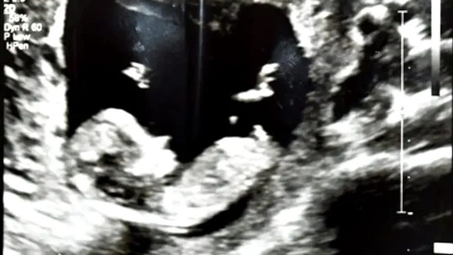 A photo of an ultrasound was found next to Fiengo's body during the investigation. (Office of the State Attorney 18th Judicial Circuit)