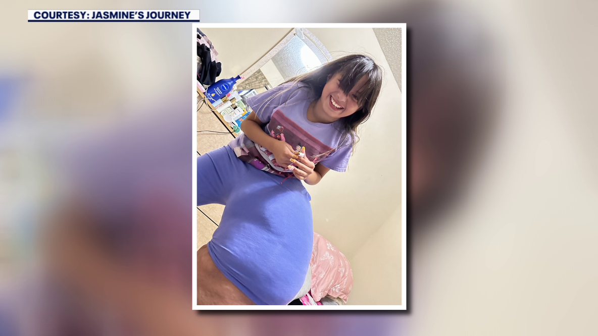 Rare condition forces St. Petersburg doctors to amputate teen's leg