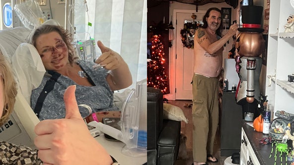 Couple recovering after being struck in Gulfport hit-and-run crash while on e-scooter: 'Left us for dead'