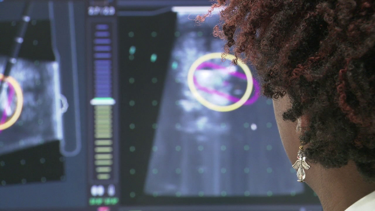 State law creating uterine fibroid research database not implemented 4 years later – what 1 lawmaker is doing