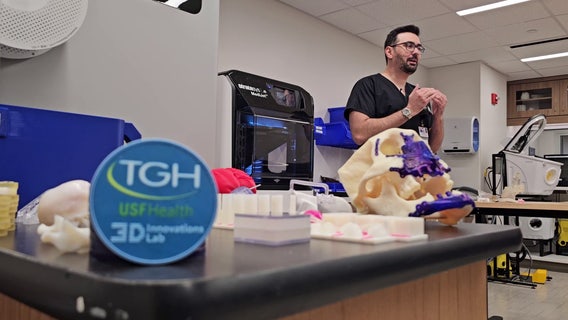 3D printed organs helping TGH doctors better prepare for difficult surgeries