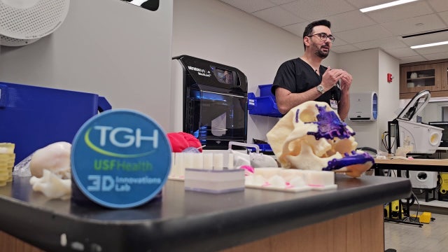 3D printed organs helping TGH doctors better prepare for difficult surgeries