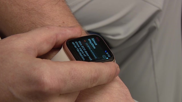 Smartwatch Health Alerts: Tampa cardiologist shares when to see a doctor