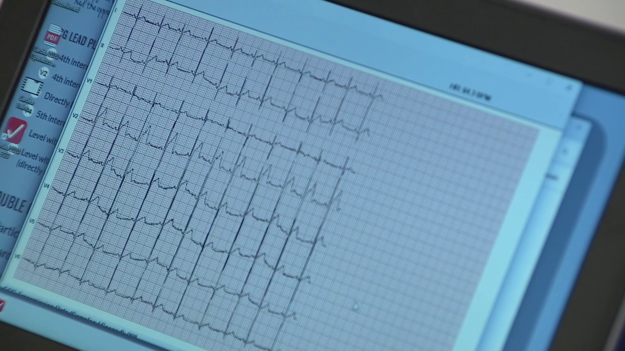 BayCare, Florida nonprofit offers heart screenings ahead of new ECG law for first-time high school athletes