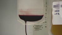 Blood shortage: OneBlood sees critical supply drop, forcing urgent call for donors