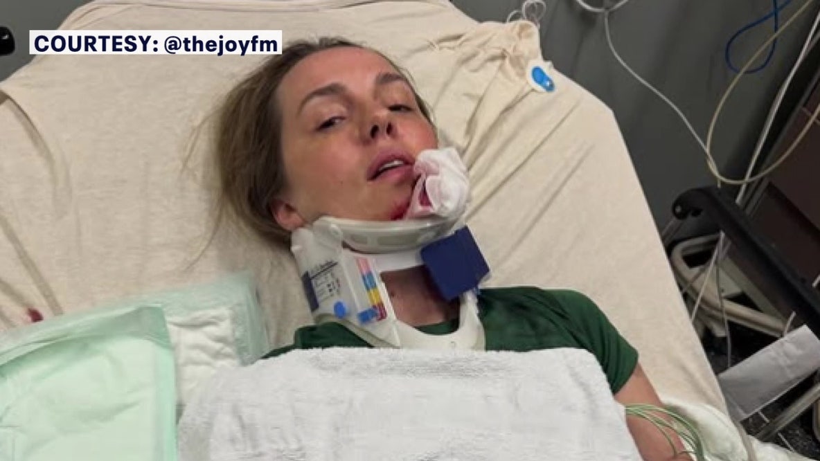 ‘You’re talking life and death’: Bay Area radio host warns parents after e-bike crash