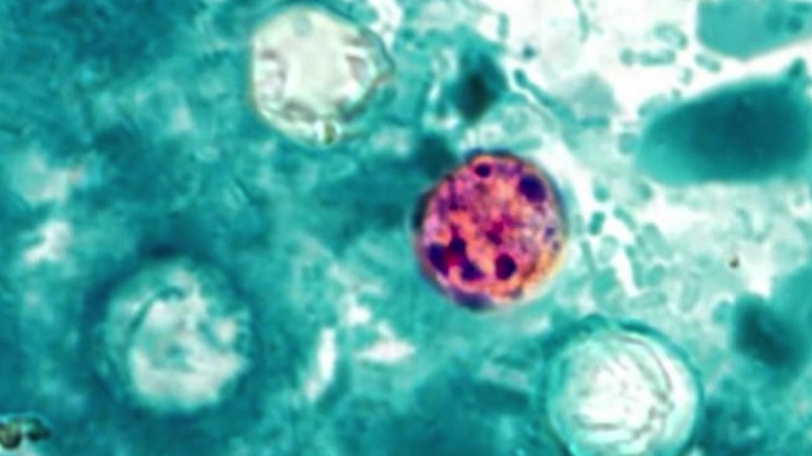 Florida Cyclosporiasis cases rise to 460: Here’s a county-by-county breakdown
