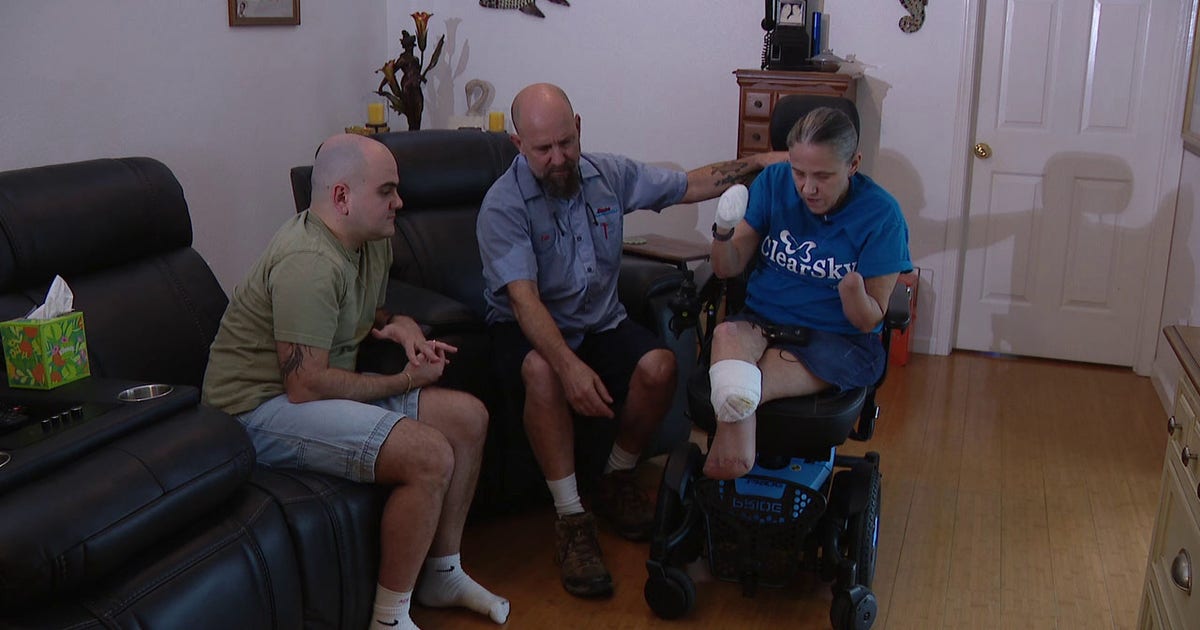 Citrus County woman returns home after surviving septic shock, amputations