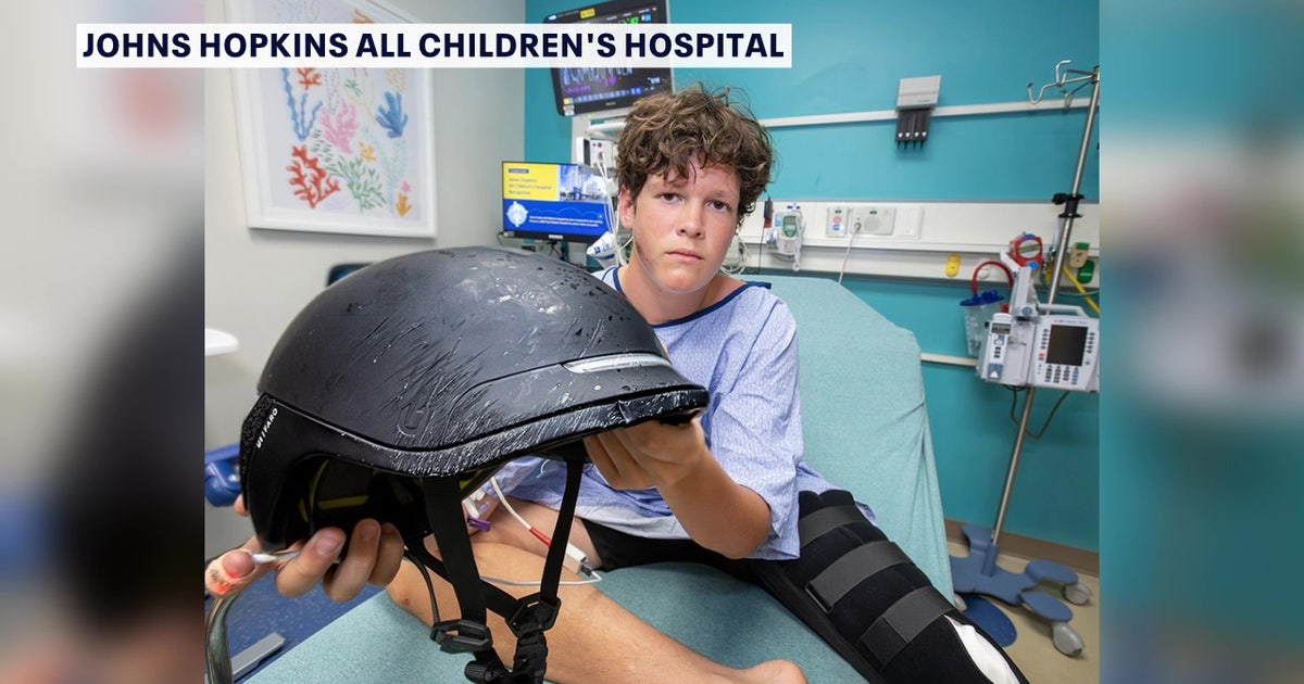 Teen credits helmet for saving his life after e-bike crash, doctors warn of injury increase