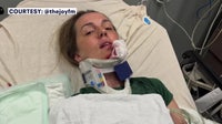 ‘You’re talking life and death’: Bay Area radio host warns parents after e-bike crash