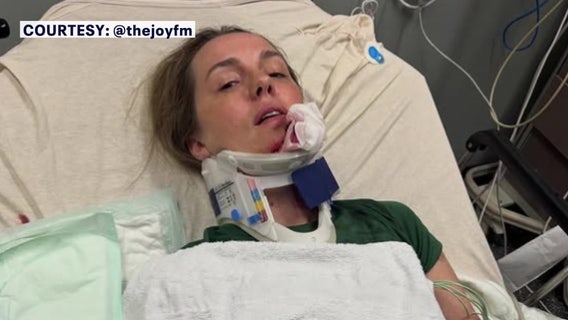 ‘You’re talking life and death’: Bay Area radio host warns parents after e-bike crash